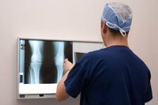 orthopaedics tauranga surgery